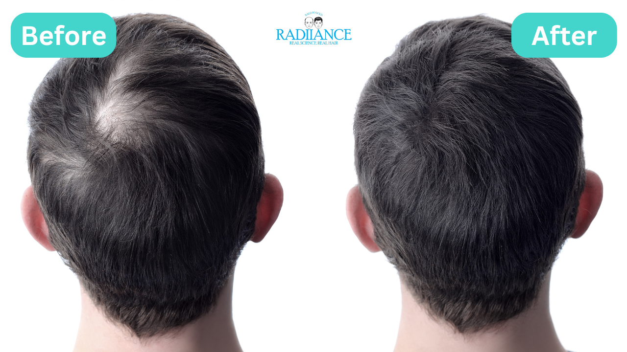 Radiance Advanced Hair Transplant Center 17266420623