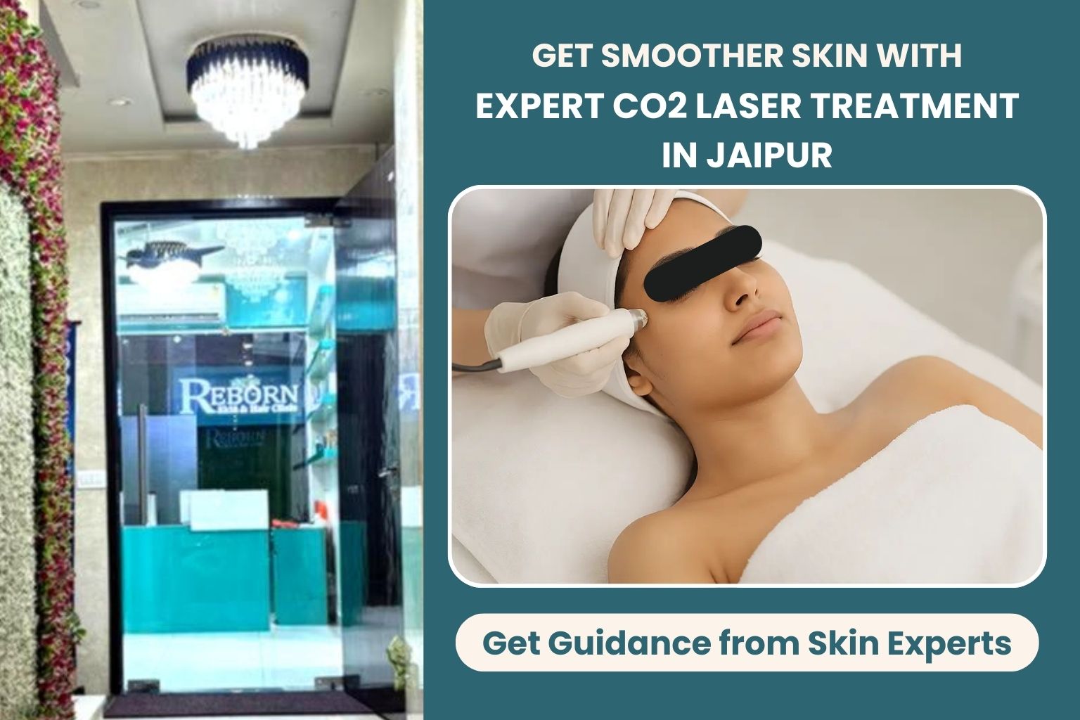 Refine Pores With Co Laser Treatment In Jaipur 17740881142