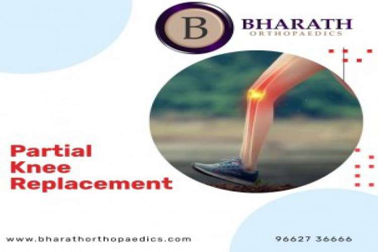 Revision Knee Replacement Dr Bharath 7645901