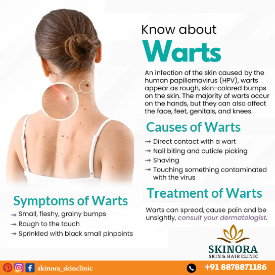 Skin Brightening Treatment In Hyderabad 17365767851
