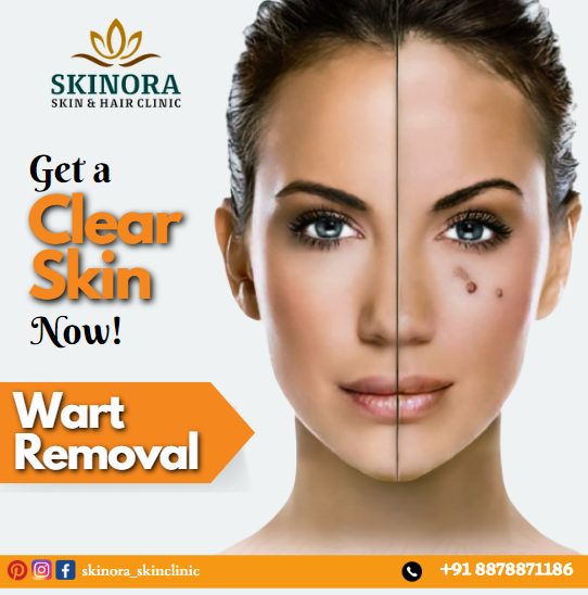 Skin Brightening Treatment In Hyderabad 17365767853
