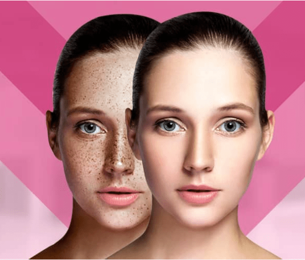 Skin Pigmentation Treatment 17149748272