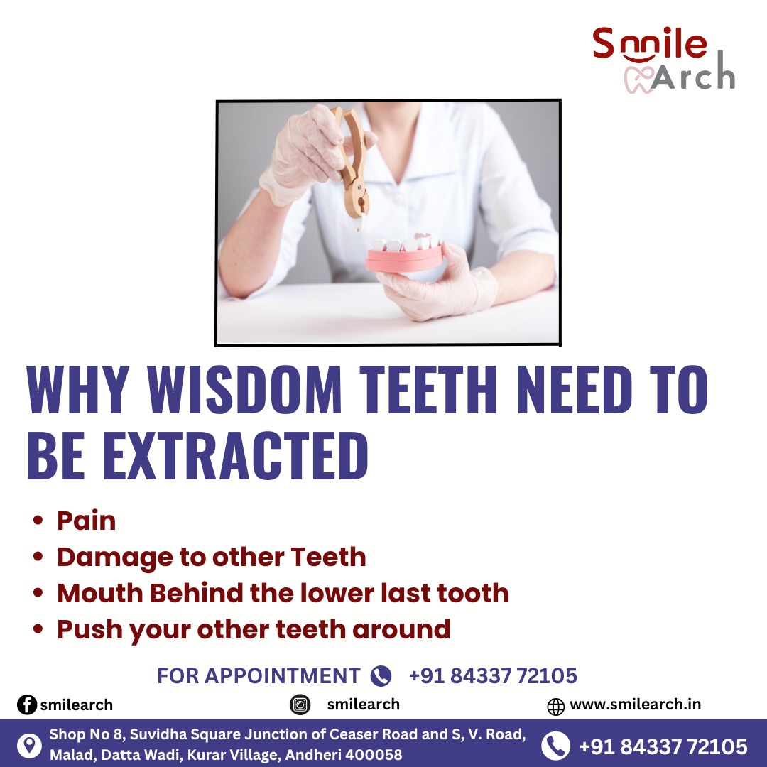 Smile Arch   Dental Care Clinic In Andheri West 17737457713