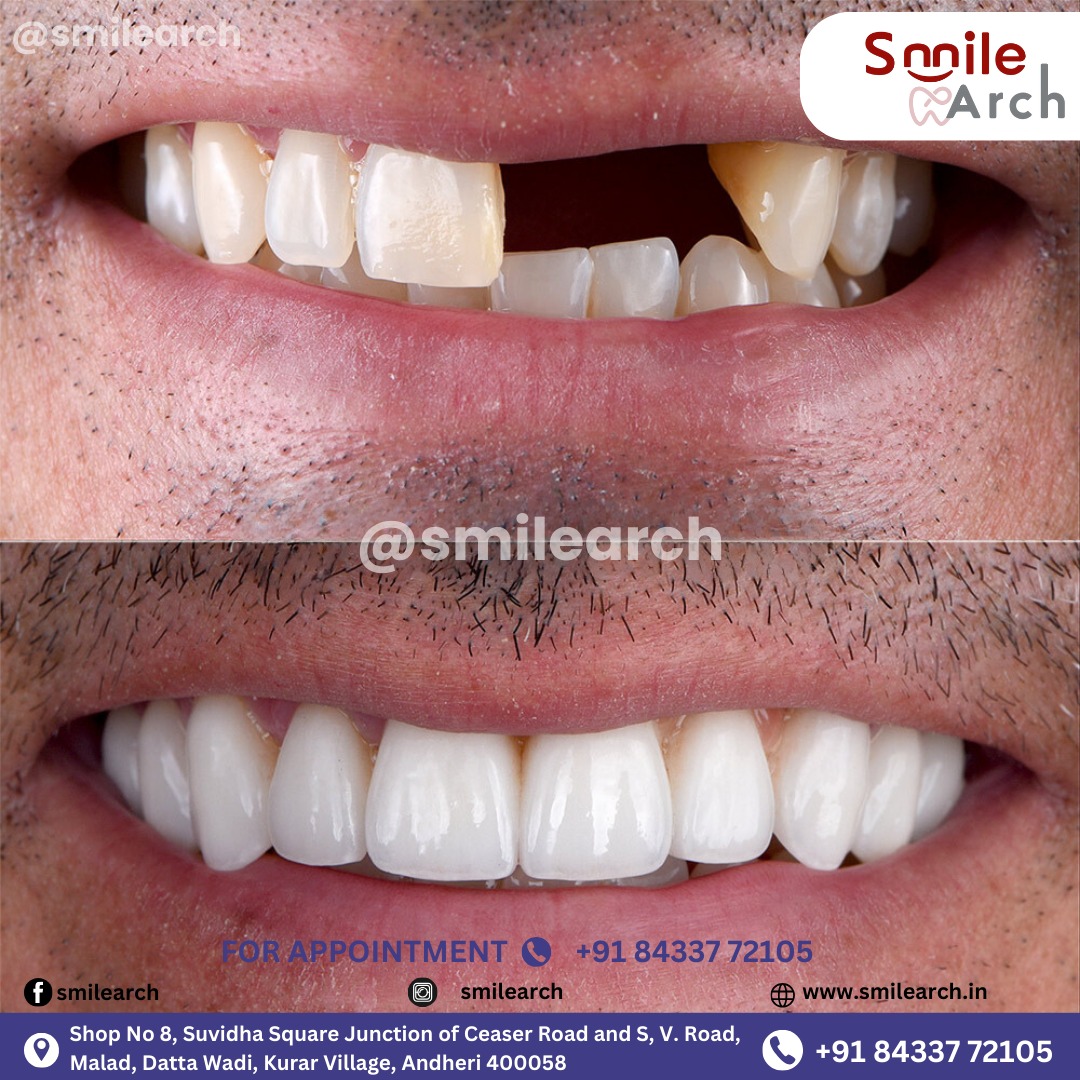 Smile Arch   Dental Care Clinic In Andheri West 17737457718