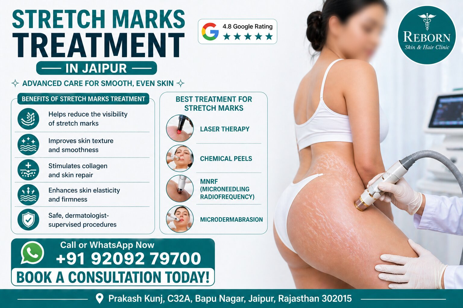 Stretch Marks Treatment In Jaipur   Book Expert Care Today 17777139291