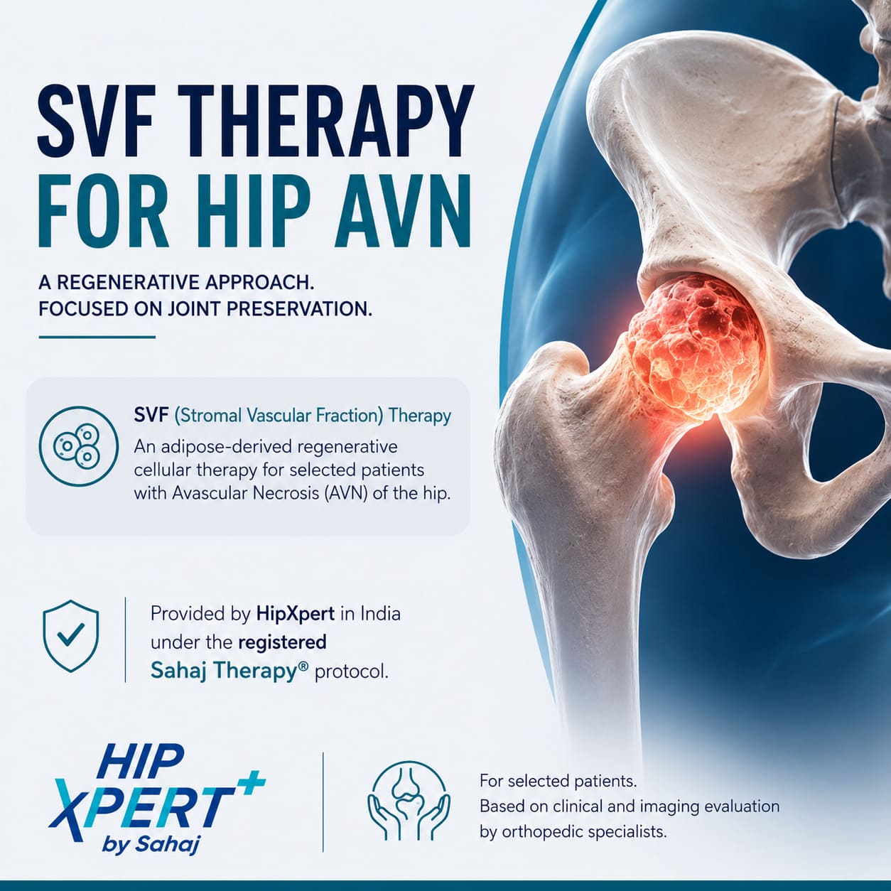 Svf Therapy For Hip Avn In India 17821125012