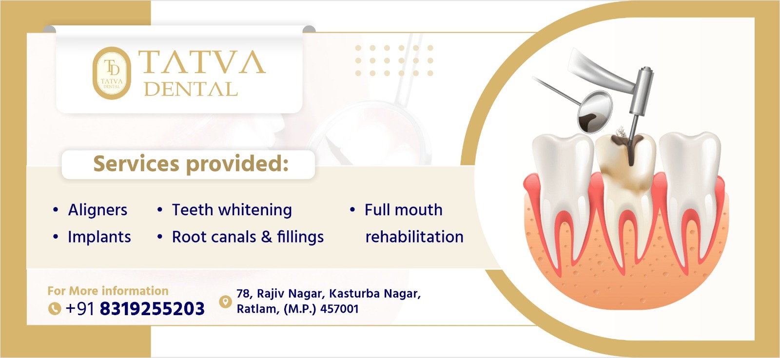 Teeth Whitening Services In Ratlam   Tatva Dental 17593060199