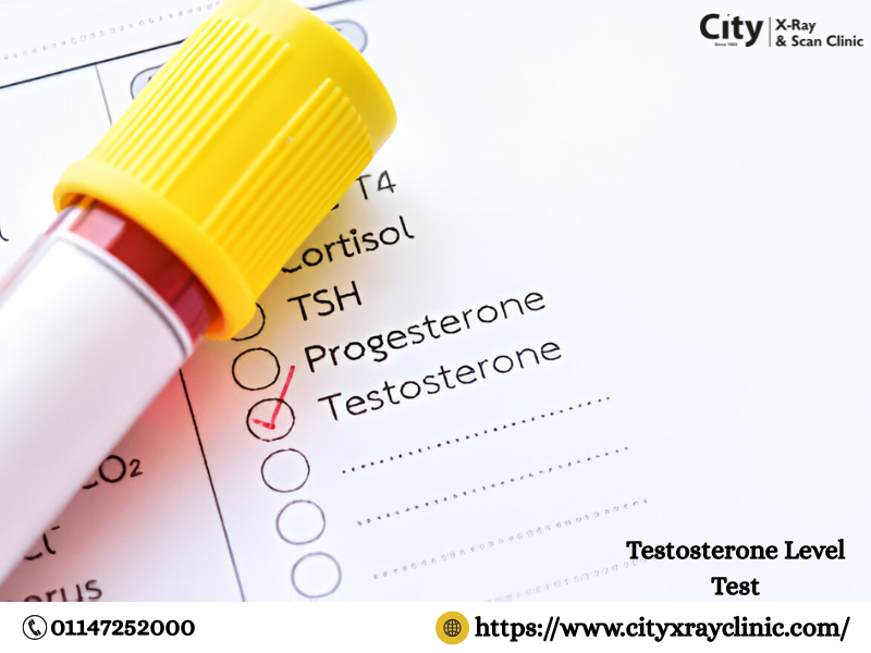 Testosterone Level Test Price Know Cost Before You Book 17516126254