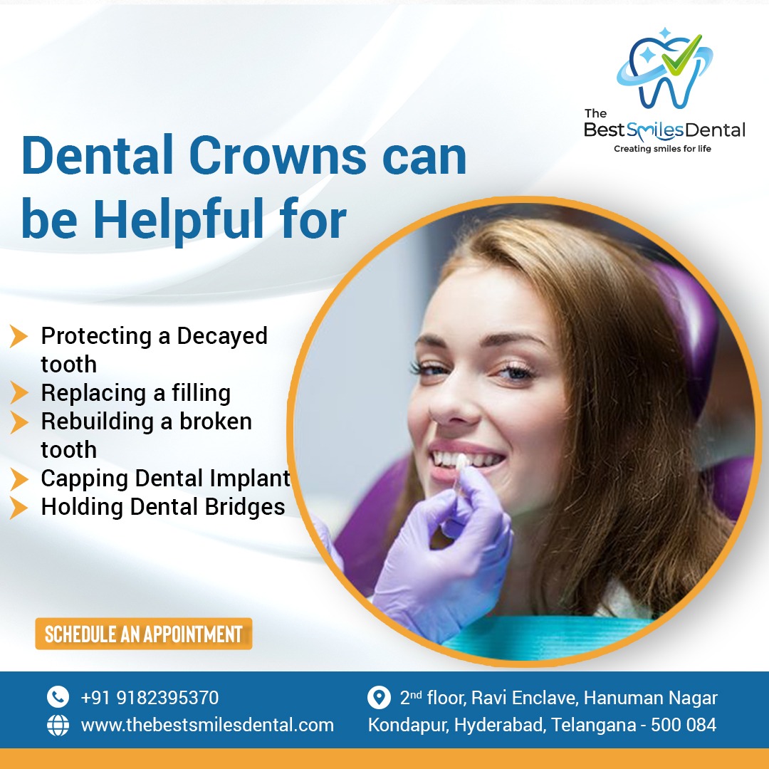 The Best Smiles Dental Clinic In Kondapur 16898380870