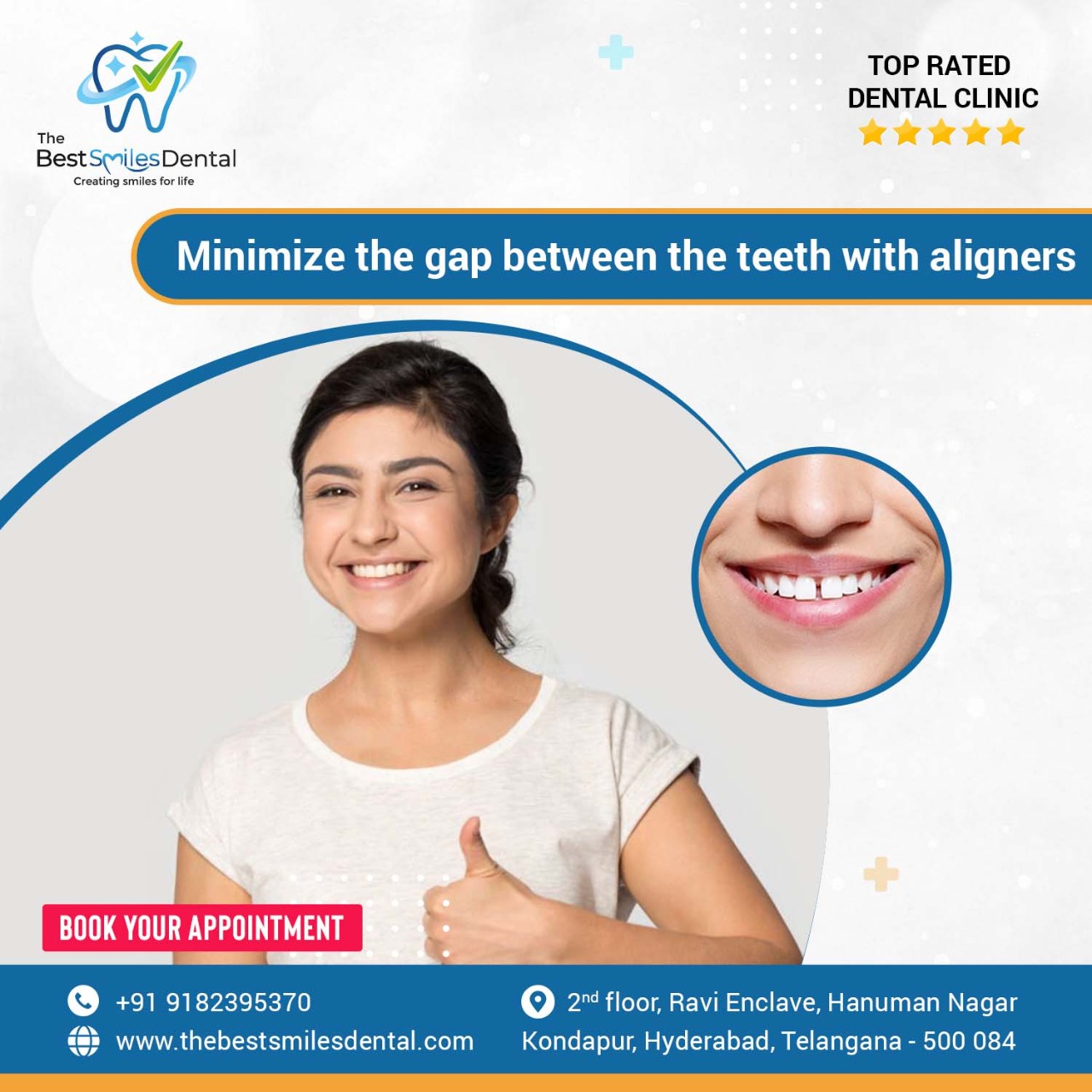 The Best Smiles Dental Clinic In Kondapur 16898380878
