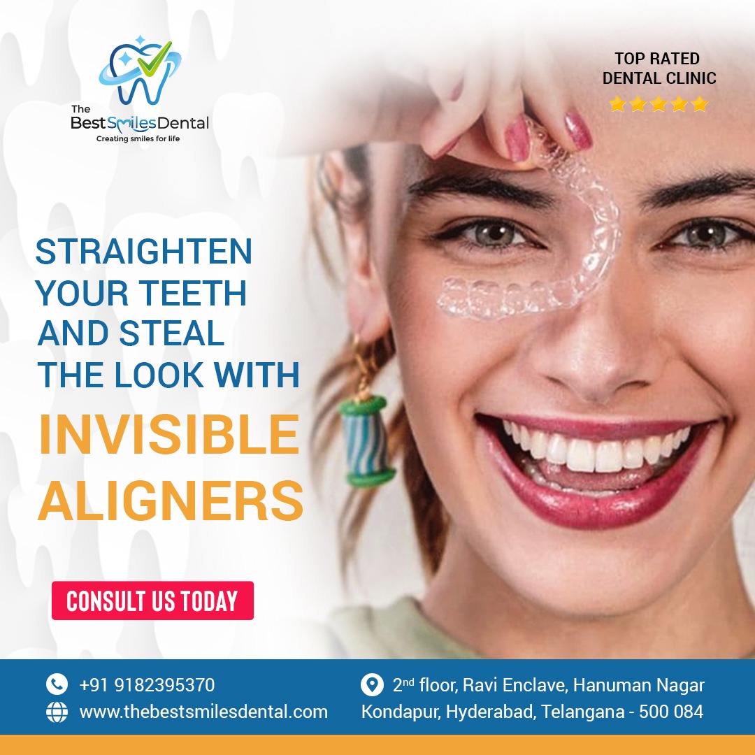 The Best Smiles Dental Clinic In Kondapur 16898380880