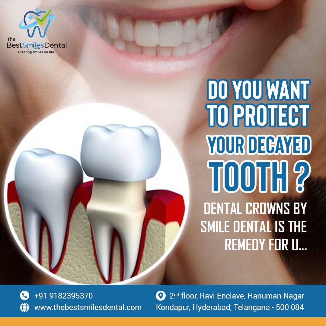 The Best Smiles Dental Clinic In Kondapur 16898380889