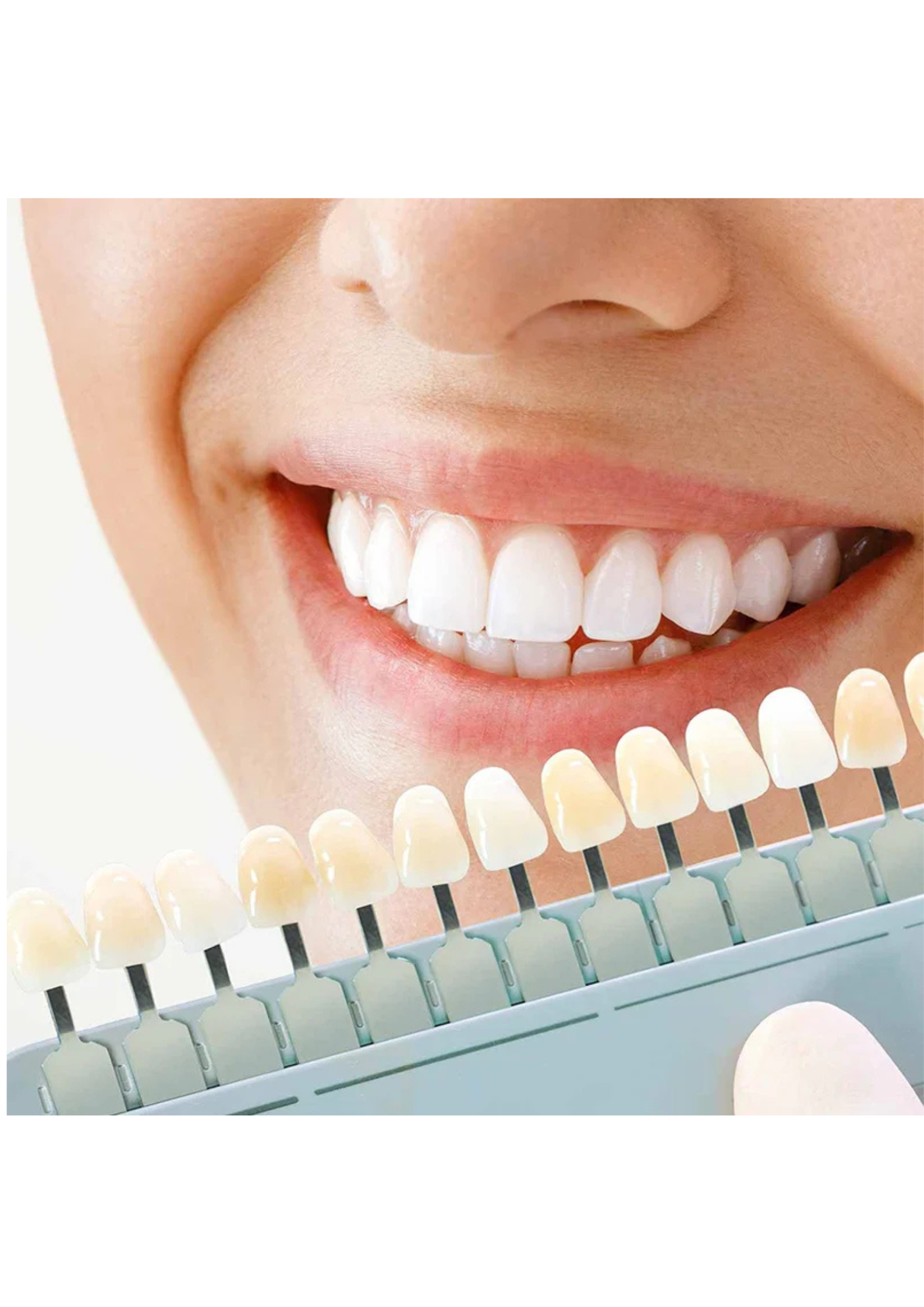Top Dental Clinic In Balewadi Vedas Dental Care 17530765899