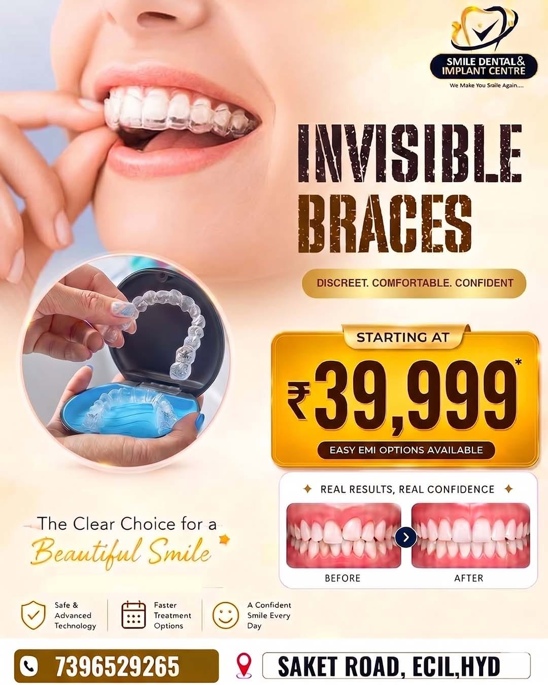 Top Rated Dental Clinic Serving Sainikpuri And Ecil 17810036221