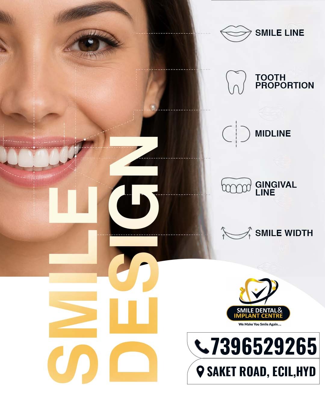 Top Rated Dental Clinic Serving Sainikpuri And Ecil 17810036226