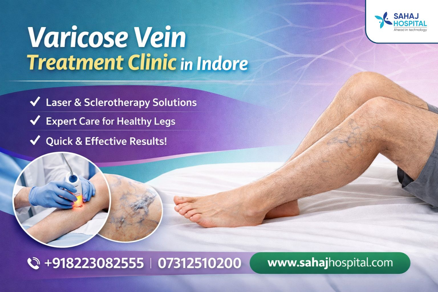 Varicose Vein Treatment Clinic In Indore Sahaj Hospital 17746730851