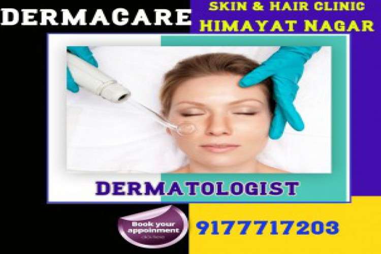 Acne Treatment in Himayat Nagar Dermatologist in Himayat Nagar