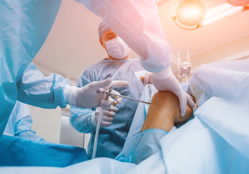 Arthroscopy Surgery In Delhi
