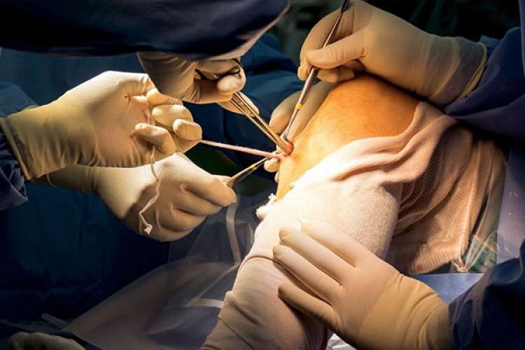 Arthroscopy Surgery In Jaipur
