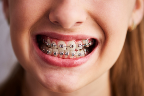 Best Dentist in Dhantoli Nagpur