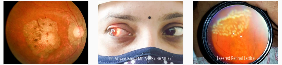 Best eye specialist in delhi