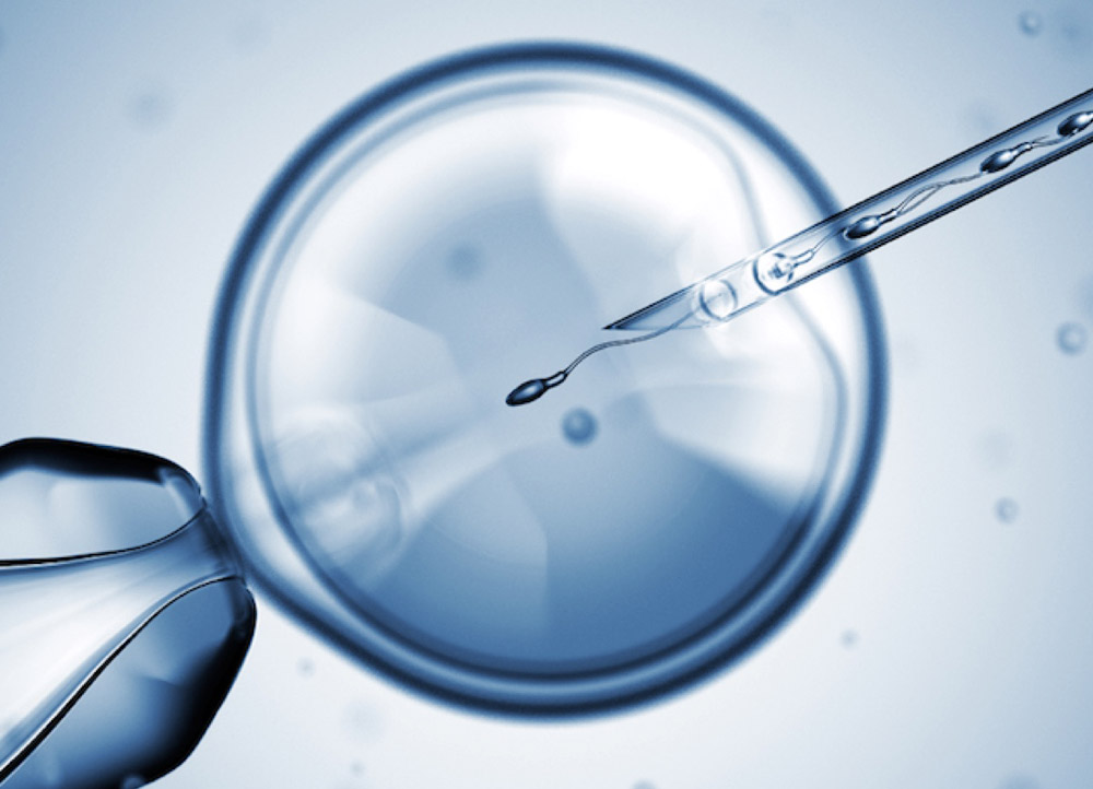 Best icsi treatment in mumbai