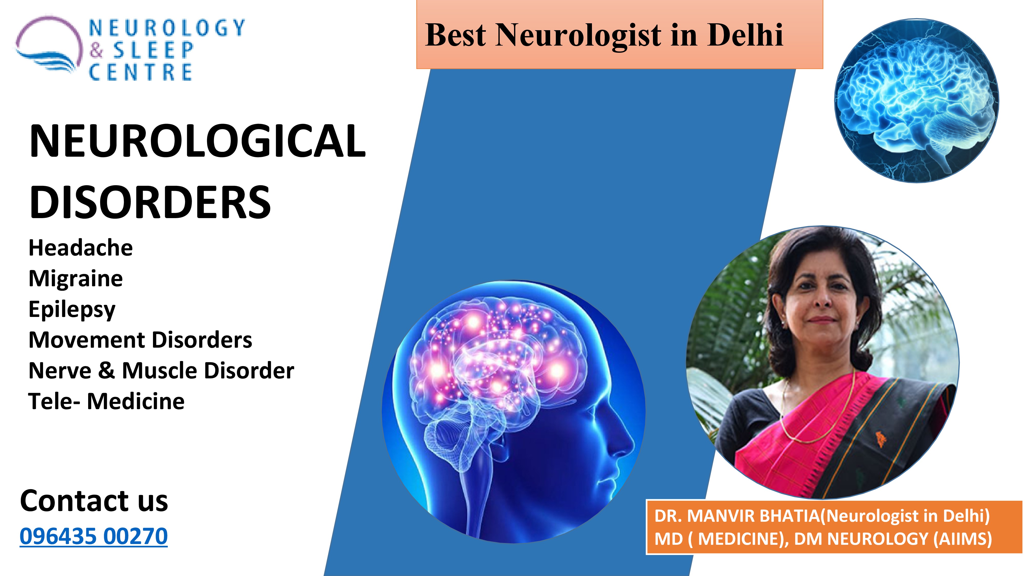 Best neurologist delhi