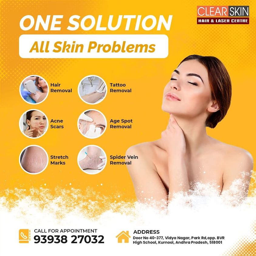 Birthmark removal treatment in hyderabad