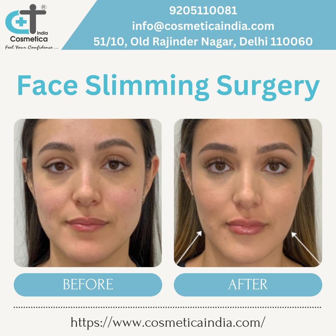 Buccal fat removal surgery