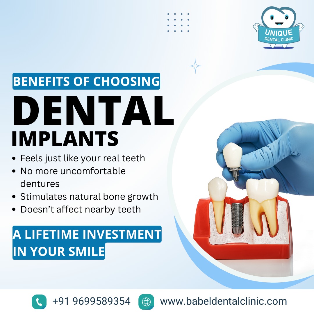 Dental implant fixing in pimple saudagar