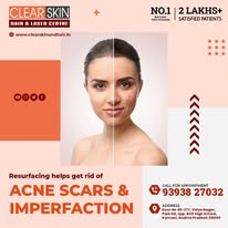 Facial port wine stain treatment in india
