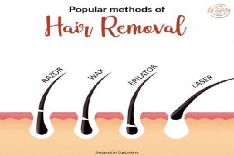 Full Body Laser Hair Removal Cost in Delhi