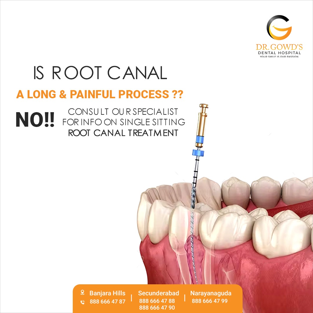 Full mouth implants cost in Hyderabad