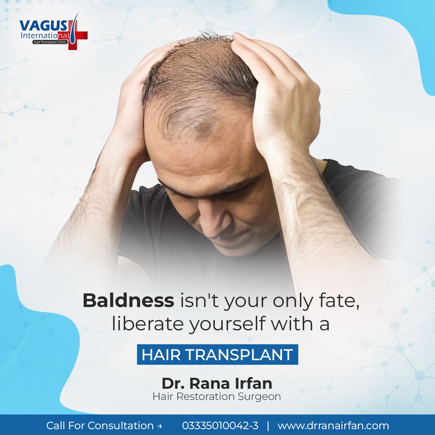 Hair Transplant Service by Dr Rana Irfan in Islamabad
