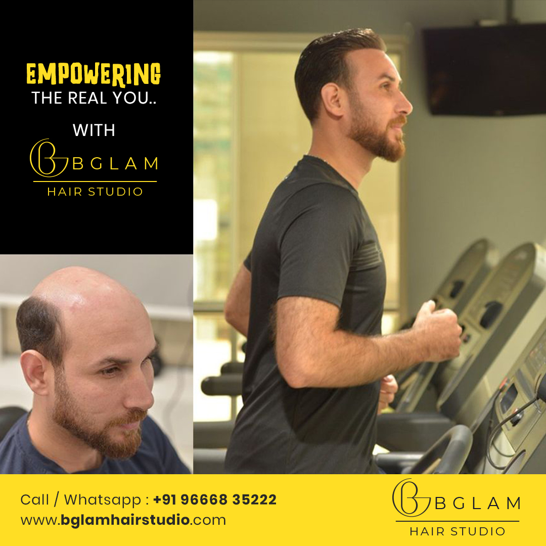 non surgical hair replacement - bglam hair studio