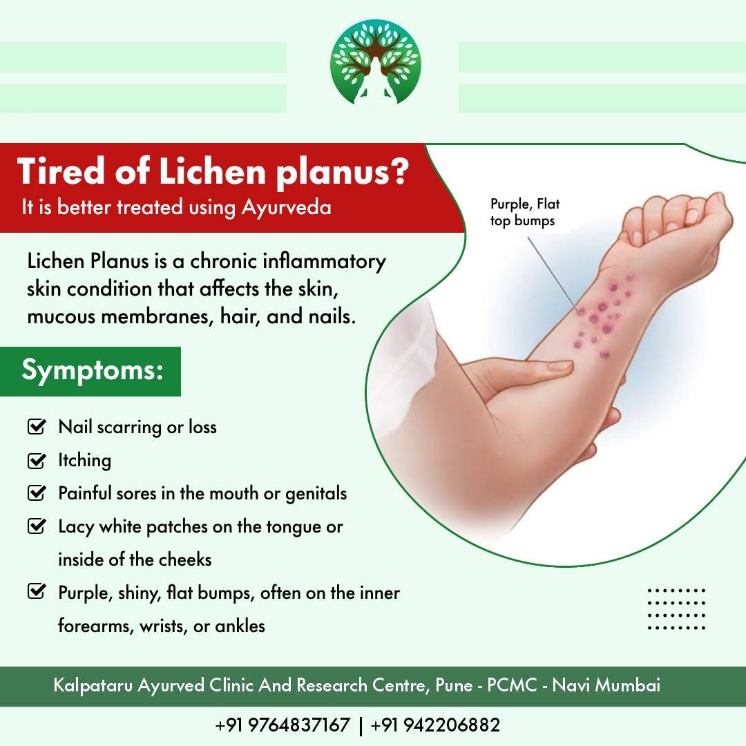 Psoriasis Treatment in Pune- Dr Manoj Deshpande