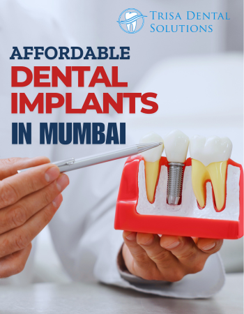 Trisa dental solutions  best dental implants clinic in mumbai
