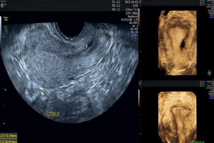 Visit Fetomat For Gynecology Ultrasound In Kolkata