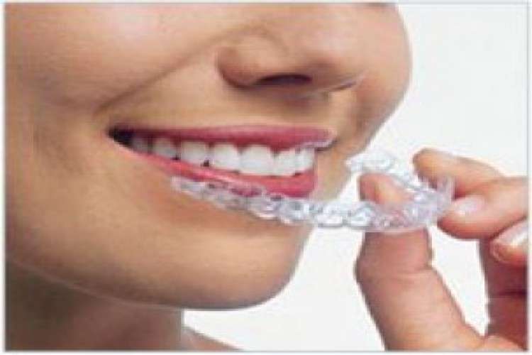 Cosmetic treatment with braces smiles dental clinic pune