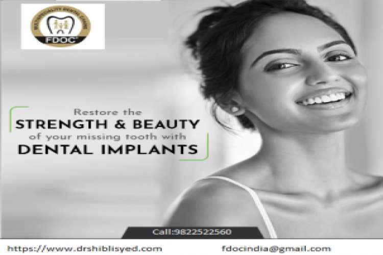Dental implants in pune
