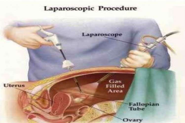 Expert laparoscpic surgeon in ahmedabad