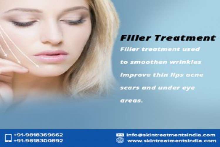 Facial filler treatment in south west delhi