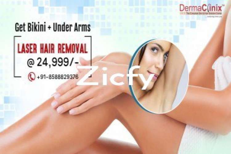 Get bikini and underarms laser hair reduction