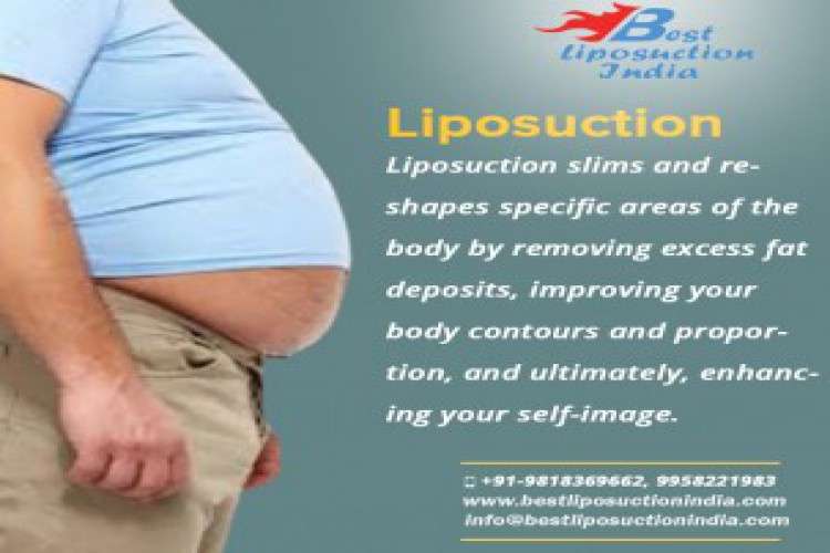 Liposuction cosmetic surgery procedure in delhi