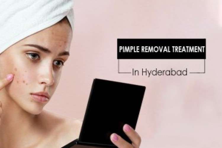 Pimple removal treatment