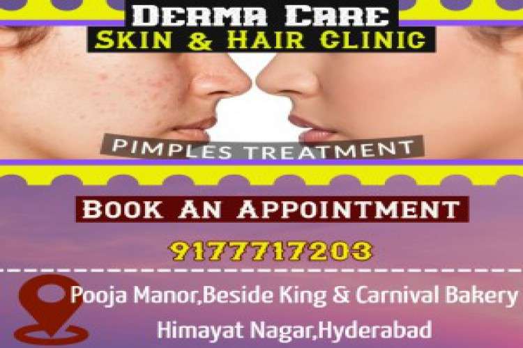 Pimple treatment in hyderabad laser tattoo removal in himayat nagar