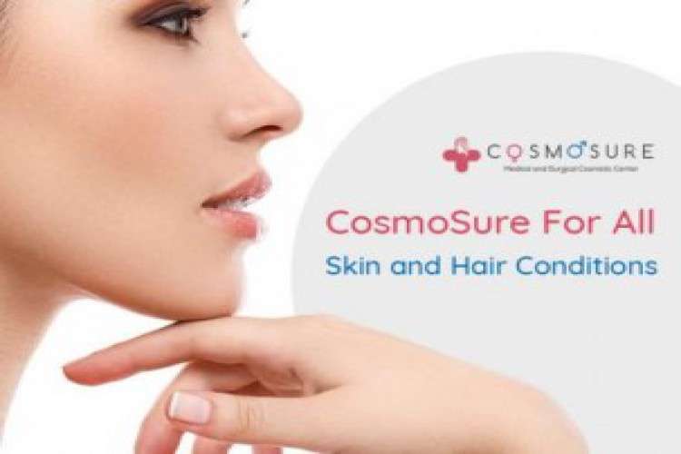 Psoriasis treatment in hyderabad cosmosure clinic