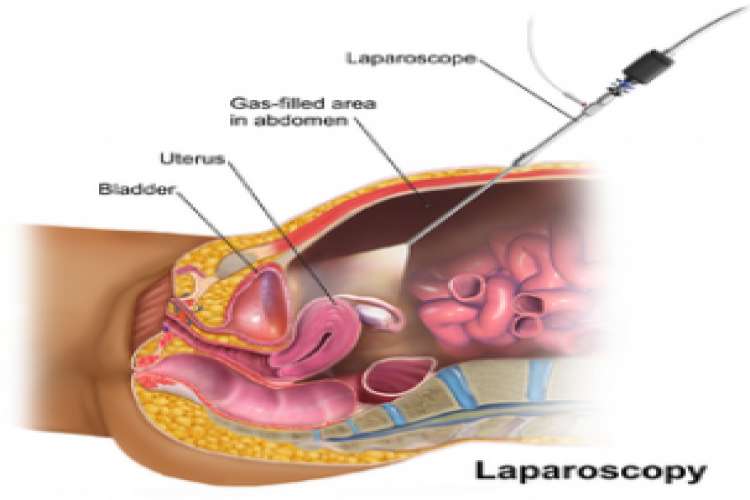 Top laparoscopic gynaecologist in ahmedabad